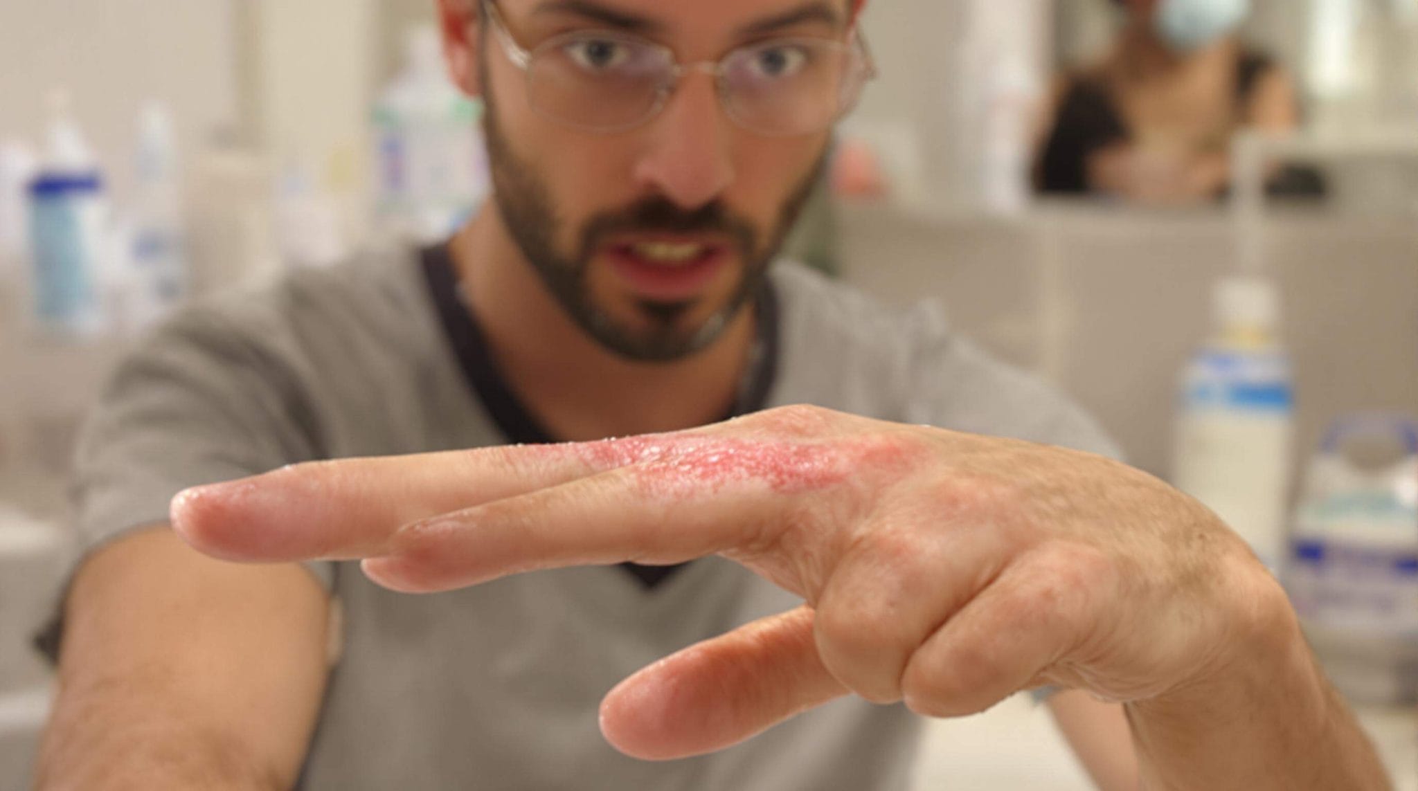 Cancer Du Poumon : Premiers Signes Et Symptômes – ECDR